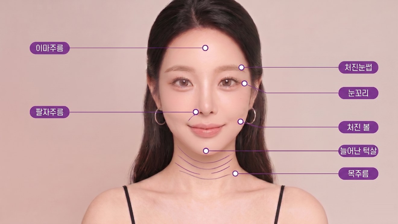 VOV Lift 시술 부위 — 이마주름·처진눈썹·눈꼬리·팔자주름·처진 볼·늘어난 턱살·목주름