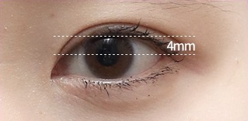 정상 눈 — 측정 일러스트