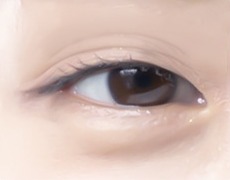 상안검 STEP 01