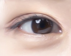 상안검 STEP 04