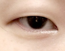 앞트임 STEP 01