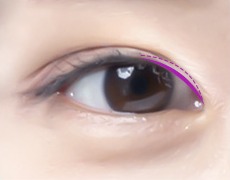 앞트임 STEP 02