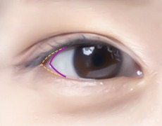 뒤트임·밑트임 STEP 02