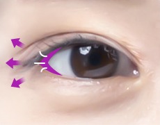 뒤트임·밑트임 STEP 03