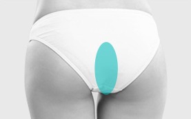 자가진피 채취 위치