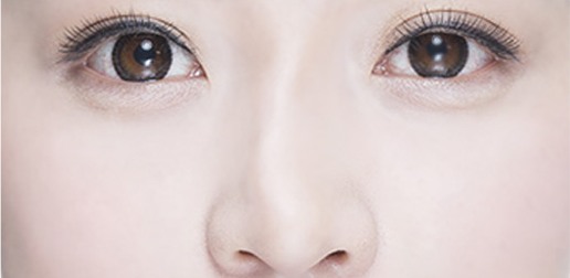 보형물이 휜 경우