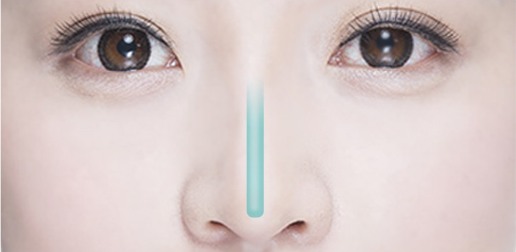 보형물이 비치는 경우