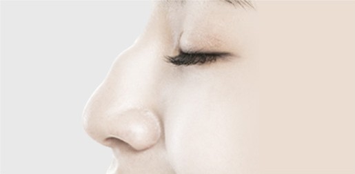 매부리코 성형(증상 약함) STEP 01 — 수술 전
