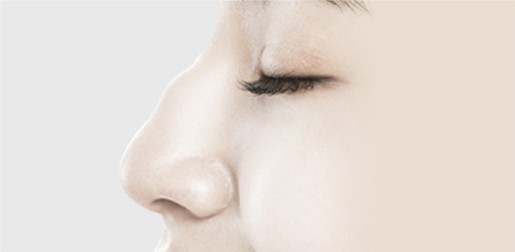 매부리코 성형(증상 심함) STEP 01 — 수술 전