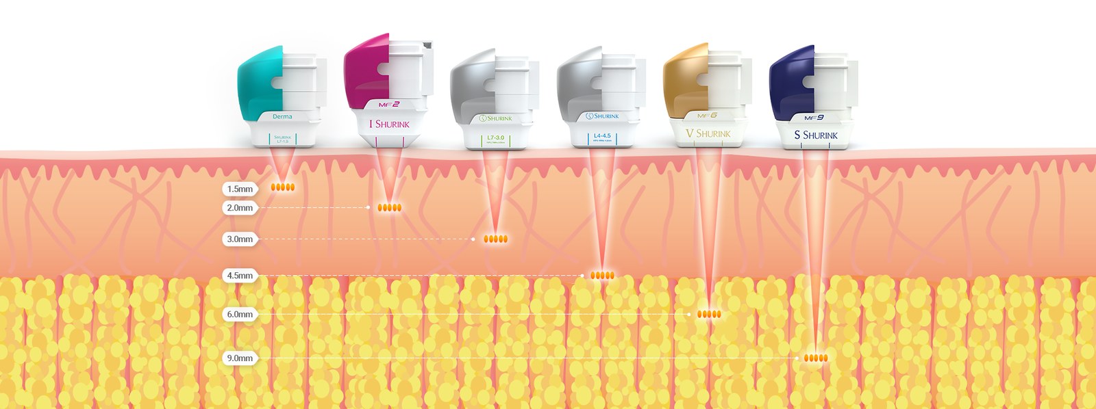 슈링크 카트리지별 피부 침투 깊이 — 더마 1.5mm · 아이 2.0mm · 3.0mm · 4.5mm · 브이 6.0mm · 에스 9.0mm
