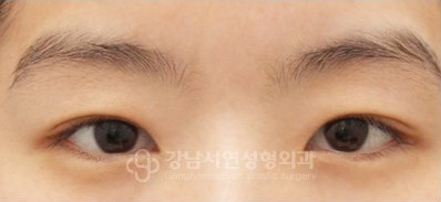 IN라인 → IN-OUT라인 변환 BEFORE