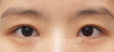 IN라인 → IN-OUT라인 변환 AFTER