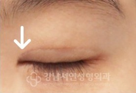안쪽 선 변환 AFTER