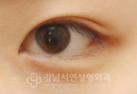 IN라인 → IN-OUT라인 변환 BEFORE