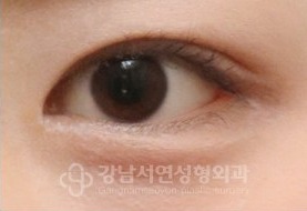 IN라인 → IN-OUT라인 변환 AFTER