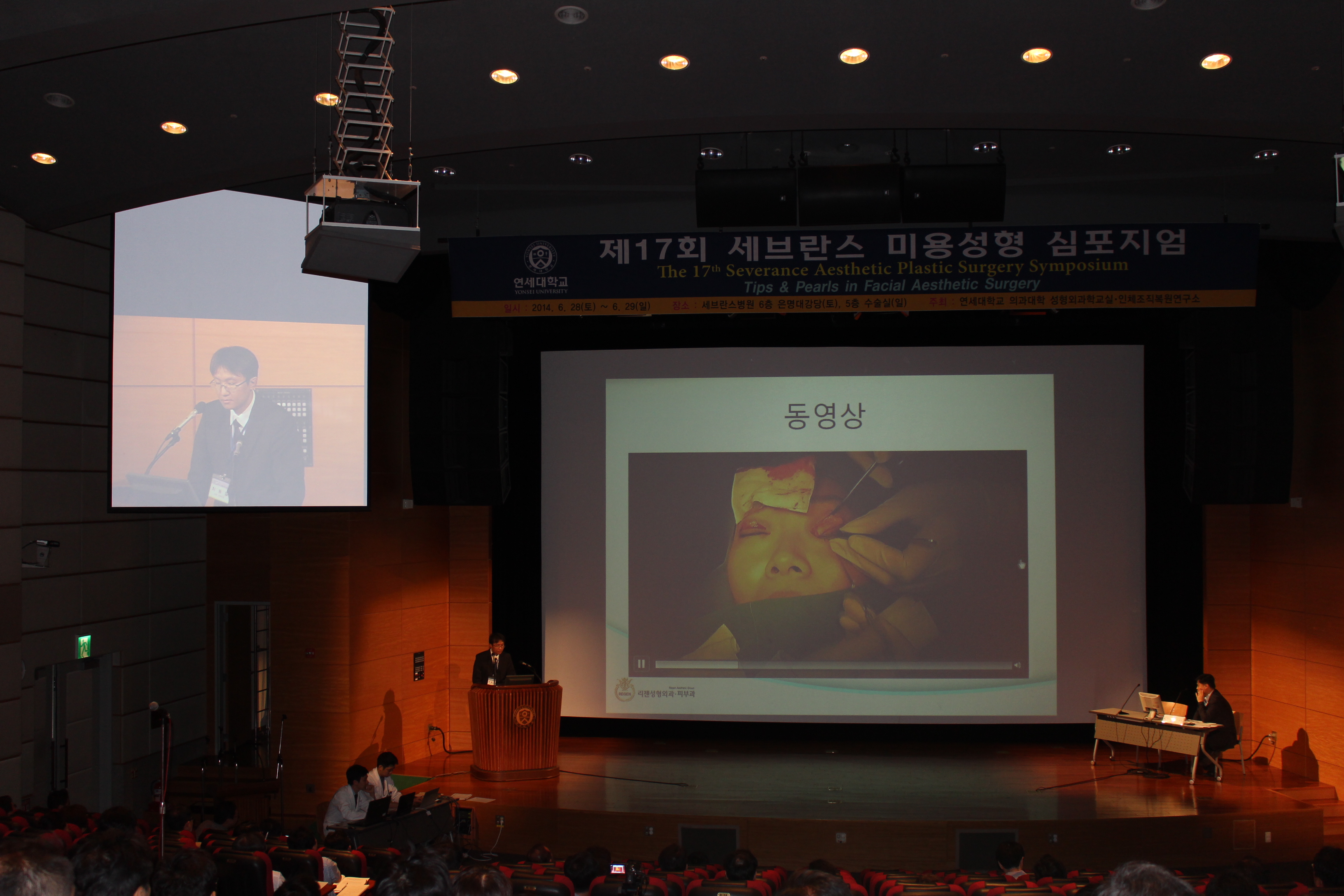 2014년 신촌세브란스 미용 심포지엄 - 절개쌍꺼풀및 눈매교정에대한 라이브 수술시연