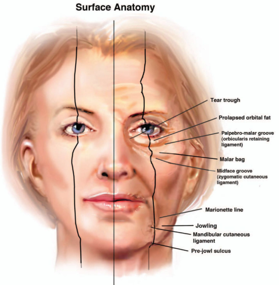 안면 노화 얼굴의 해부 anatomy 명칭. - 성형외과 전문의를 위한 포스팅 -