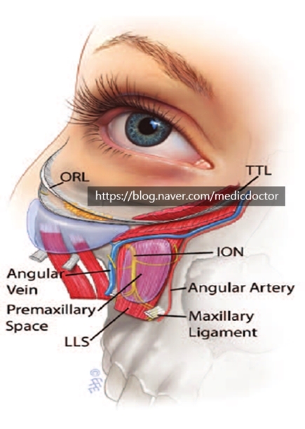 Premaxillary space- 이거를 잘 알아야 눈밑지방 재배치 수술에 도움이 된다.