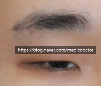 꼬막눈 짧은눈 최대한 눈을 크게 만들기