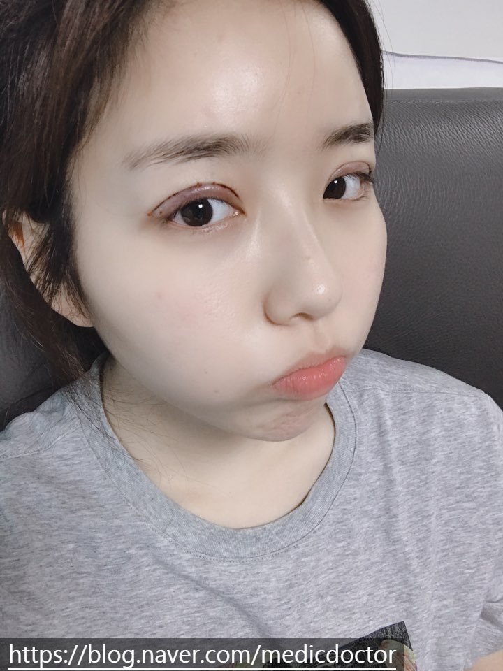 [공지] 강남서연성형외과의원을 소개합니다.
