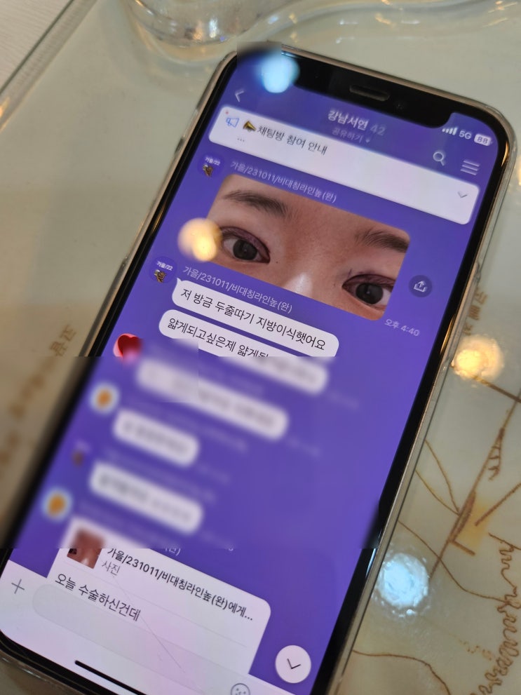 황당한일이.. 두줄따기 환자분이 알려주신 타병원의 음해(?)